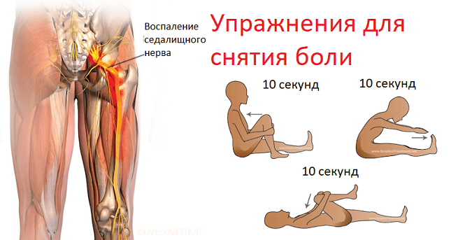 Анатомия ягодичных мышц. упругие ягодицы. 25 лучших упражнений