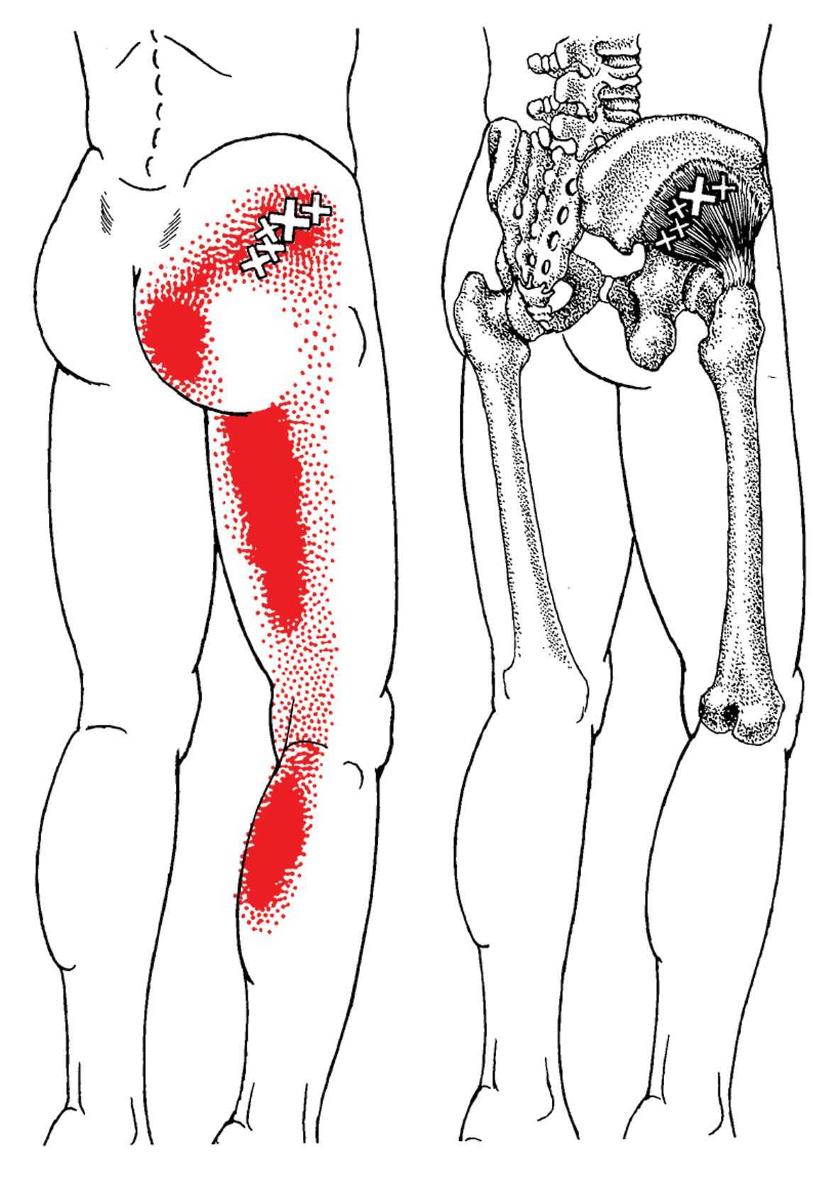 Анатомия ягодичных мышц, как подтянуть ягодицы и сделать попу упругой