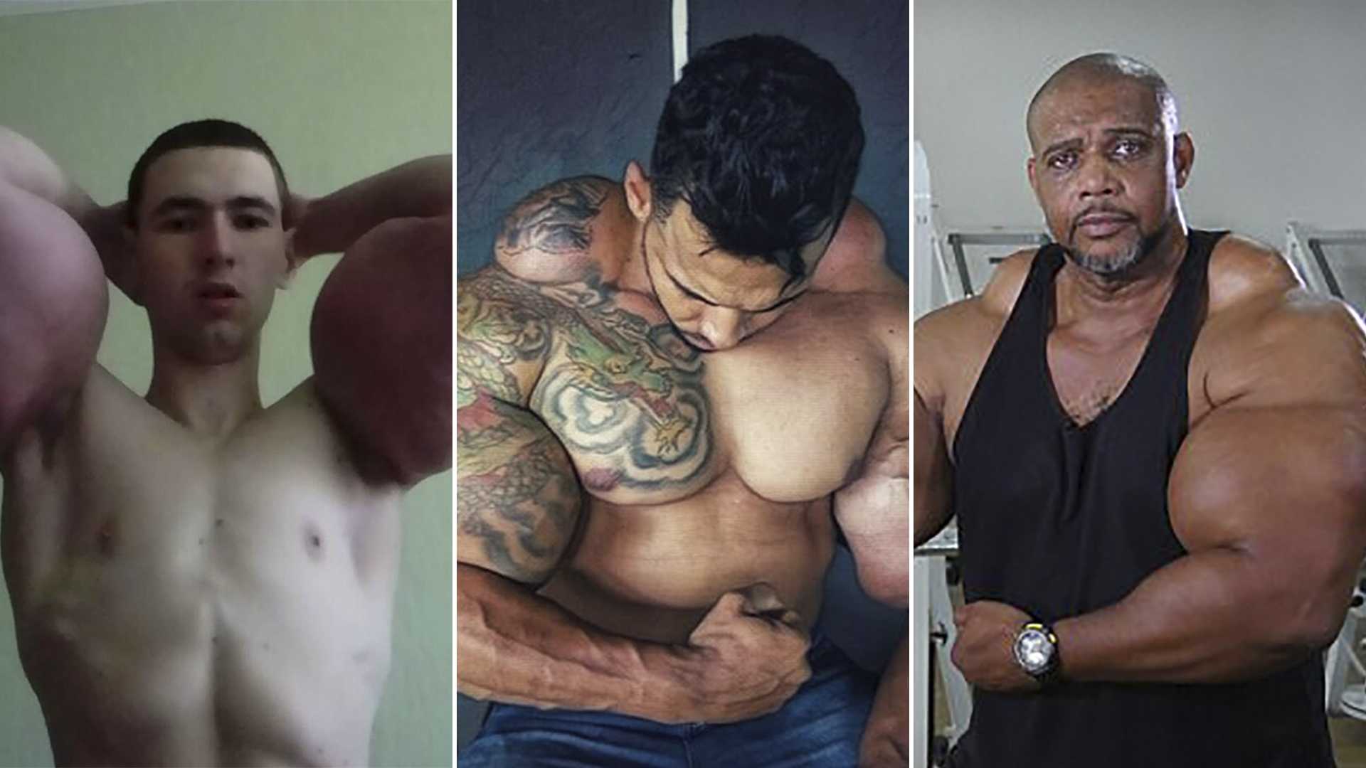 Synthol Leaking